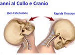 tamponamento colpo di frusta